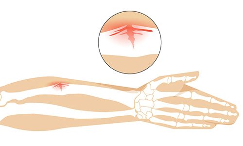 affitto magnetoterapia Milano